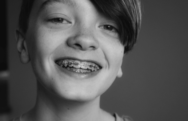 How to Take Care of Your Child’s Teeth While They Wear Braces